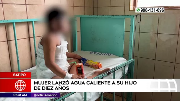 Madre quemó a su hijo en Satipo. Foto: América Noticias