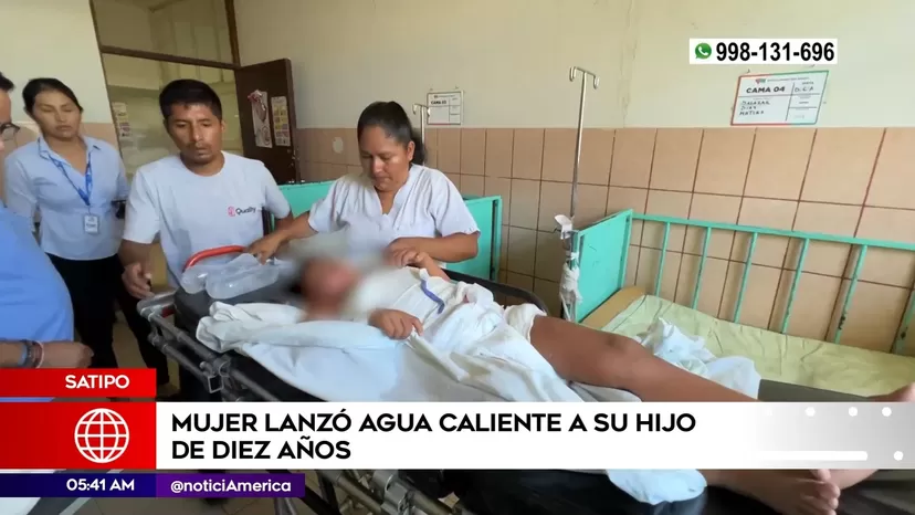 Satipo: Madre lanzó agua caliente a su hijo de 10 años