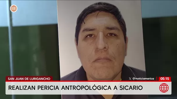 Realizan pericia antropológica a presunto sicario de empresario en San Juan de Lurigancho. Foto: América Noticias
