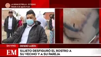 Sujeto desfiguró el rostro a vecino que celebraba su cumpleaños