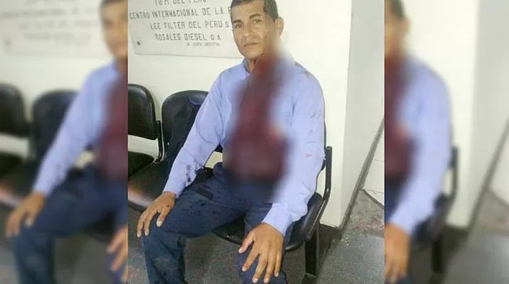 El golpe le originó graves heridas y abundante sangrado al inspector / Foto: Municipalidad de Lima El golpe le originó graves heridas y abundante sangrado al inspector / Foto: Municipalidad de Lima