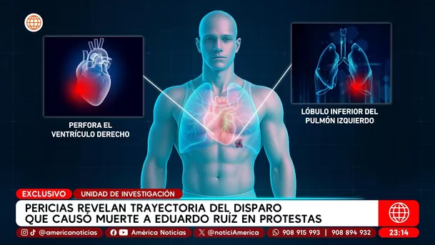 Pericias revelan trayectoria del disparo que causó muerte de Eduardo Ruíz en protestas. Foto: Unidad de investigación Pericias revelan trayectoria del disparo que causó muerte de Eduardo Ruíz en protestas. Foto: Unidad de investigación