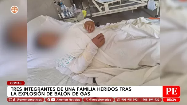 Tres heridos tras explosión de balón de gas en una vivienda en Comas. Foto: América Noticias Tres heridos tras explosión de balón de gas en una vivienda en Comas. Foto: América Noticias