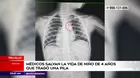 Trujillo: Médicos salvan la vida de un niño de 4 años que tragó una pila