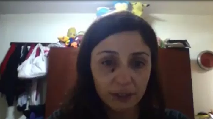 Valiente testimonio: mujer grabó video después de haber sido golpeada por su pareja Valiente testimonio: mujer grabó video después de haber sido golpeada por su pareja