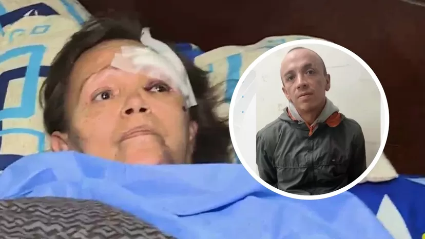 Ventanilla: Hombre atacó a su madre con un balón de gas