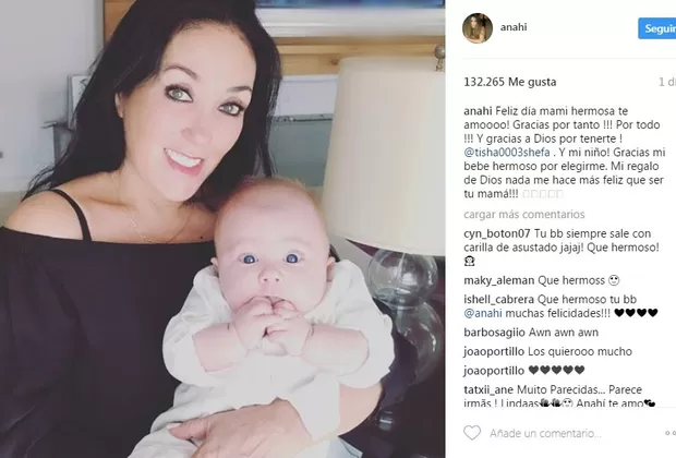 Anahí causó revuelo con fotografía tras presunta cirugía en el rostro 