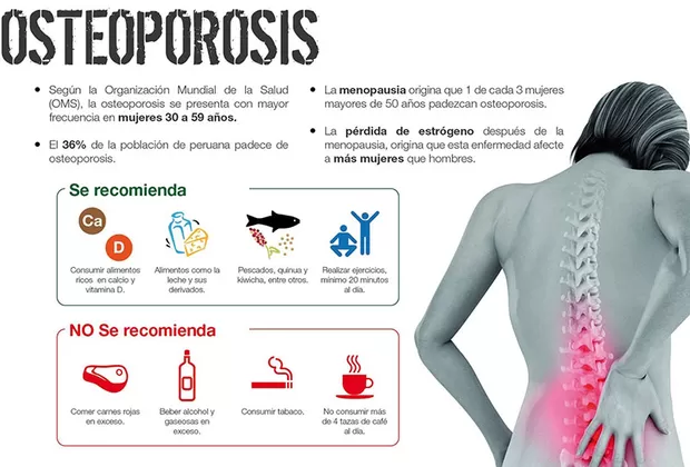 osteoporosis recomendaciones