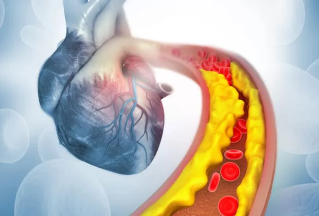 como bajar el colesterol malo