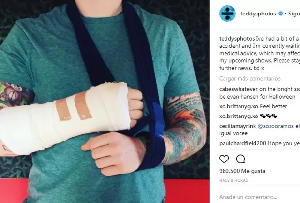 Ed Sheeran fue atropellado