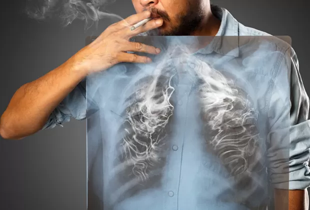 enfermedades por fumar y que les pasa a los exfumadores