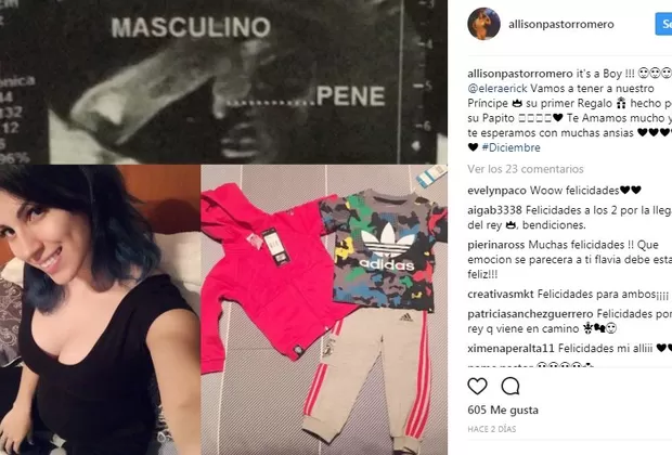 Erick Elera y Allison Pastor tendrán un varón