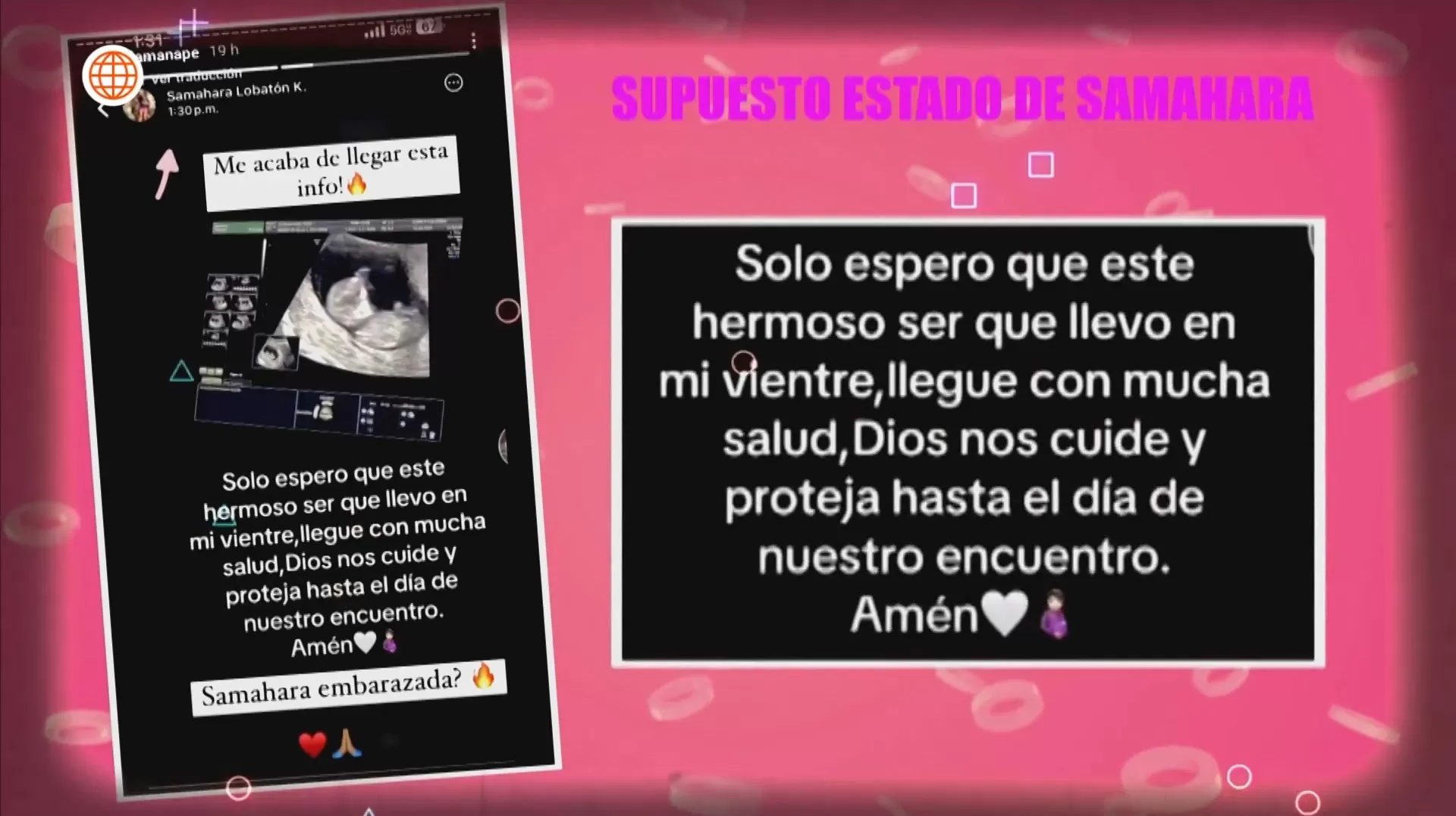 Samahara Lobatón se pronunció acerca del supuesto hijo que espera de Bryan Torres/Foto: TikTok