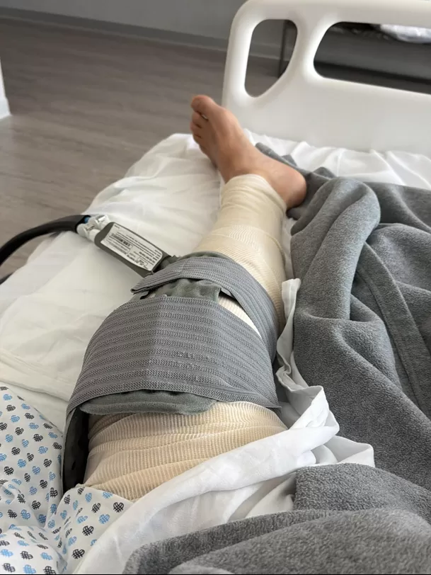 Actor de Rebelde fue operado por tercera vez de la rodilla/Ig:@ponchohd Actor de Rebelde fue operado por tercera vez de la rodilla/Ig:@ponchohd
