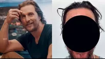 Matthew McConaughey se volvió vira por la culpa de una abeja ¿Qué le pasó?/Fotos: Instagram