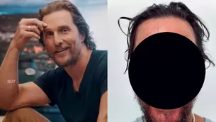 Matthew McConaughey se volvió vira por la culpa de una abeja ¿Qué le pasó?/Fotos: Instagram