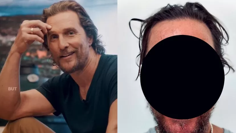 Matthew McConaughey sufrió picadura de abeja: ¿Cómo quedó su rostro?