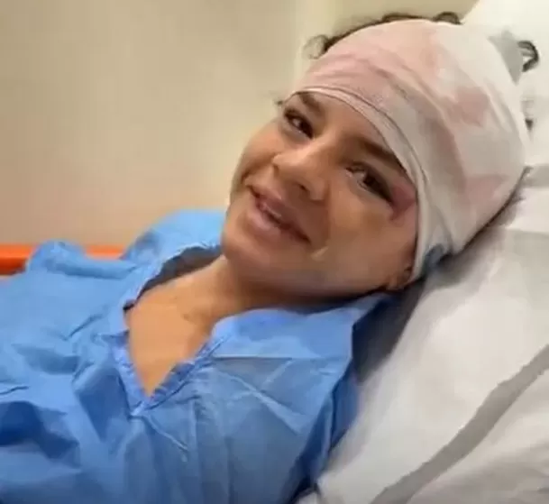 Thamara Medina, hermana de Alejandra Baigorria, sufrió un aparatoso accidente cuando regresaba a Lima desde Paracas / Captura