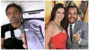 Alessandra Rosaldo reveló que Eugenio Derbez batalla con nuevos y fuertes dolores en su recuperación.