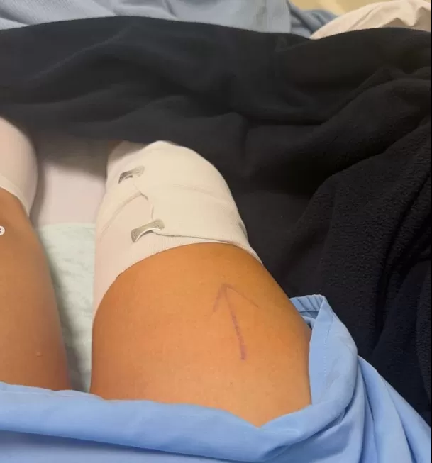 llison Pastor sorprendió al aparecer desde una clínica y revelar que ya fue operada. La modelo aseguró que todo salió bien y ahora inicia su recuperación. Foto: IG @allisonpastorromero llison Pastor sorprendió al aparecer desde una clínica y revelar que ya fue operada. La modelo aseguró que todo salió bien y ahora inicia su recuperación. Foto: IG @allisonpastorromero