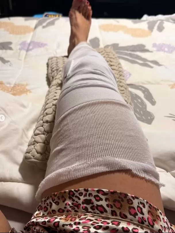 Allison Pastor preocupó a sus seguidores al aparecer desde una clínica luego de lesionarse durante la semifinal de Esto Es Guerra. La competidora contó cómo evoluciona su estado de salud Foto: EEG Allison Pastor preocupó a sus seguidores al aparecer desde una clínica luego de lesionarse durante la semifinal de Esto Es Guerra. La competidora contó cómo evoluciona su estado de salud Foto: EEG