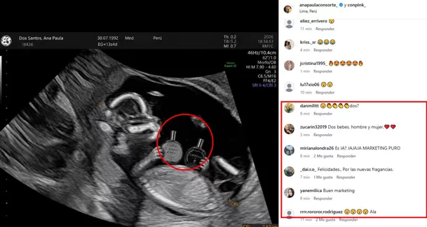 ¿Ana Paula Consorte confirma embarazo? / IG: @anapaulaconsorte_ ¿Ana Paula Consorte confirma embarazo? / IG: @anapaulaconsorte_