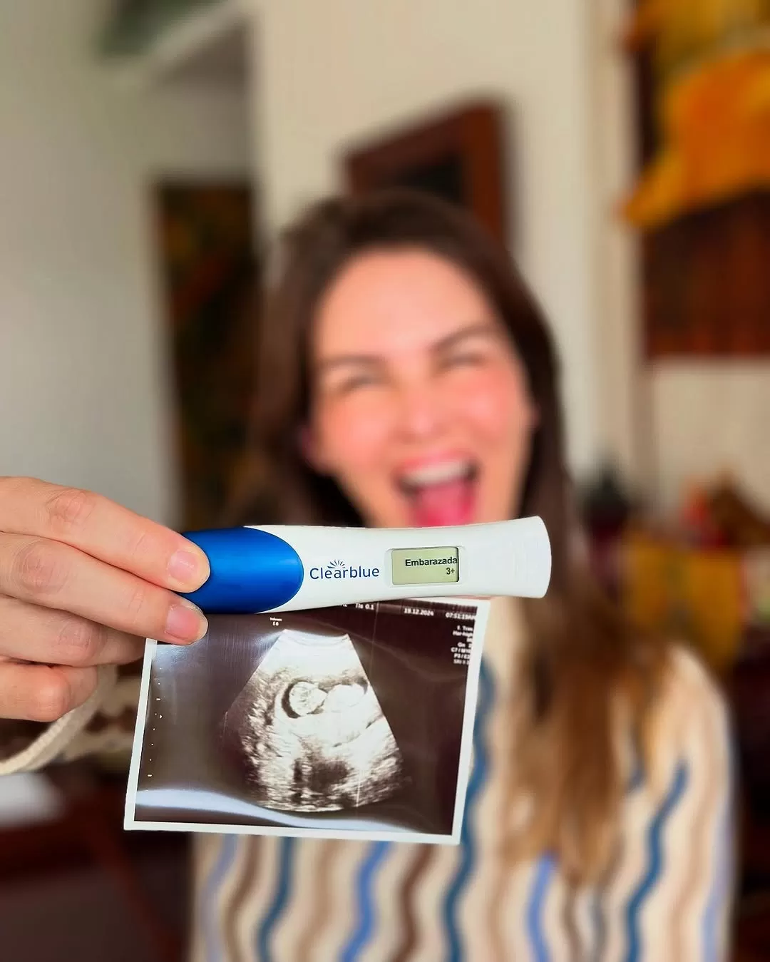 Anahí de Cárdenas, de 41 años, calificó su embarazo como “el milagro más grande”. Fuente: Instagram Anahí de Cárdenas, de 41 años, calificó su embarazo como “el milagro más grande”. Fuente: Instagram