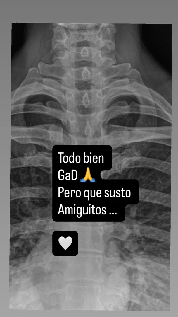 Anahí sufrió fuerte caída mientras entrenaba y terminó haciéndose radiografías/ Captura Instagram
