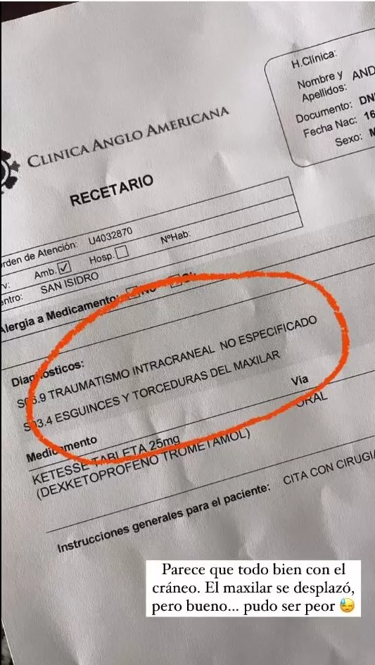 Andrés Wiese sufrió esguinces y torceduras en el maxilar tras un accidente durante un partido de fútbol/ Foto: Instagram