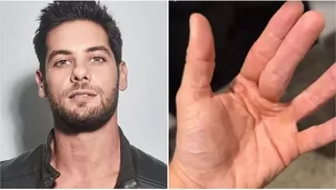 Andrés Wiese hace desesperado pedido de auxilio por misteriosa enfermedad / Instagram