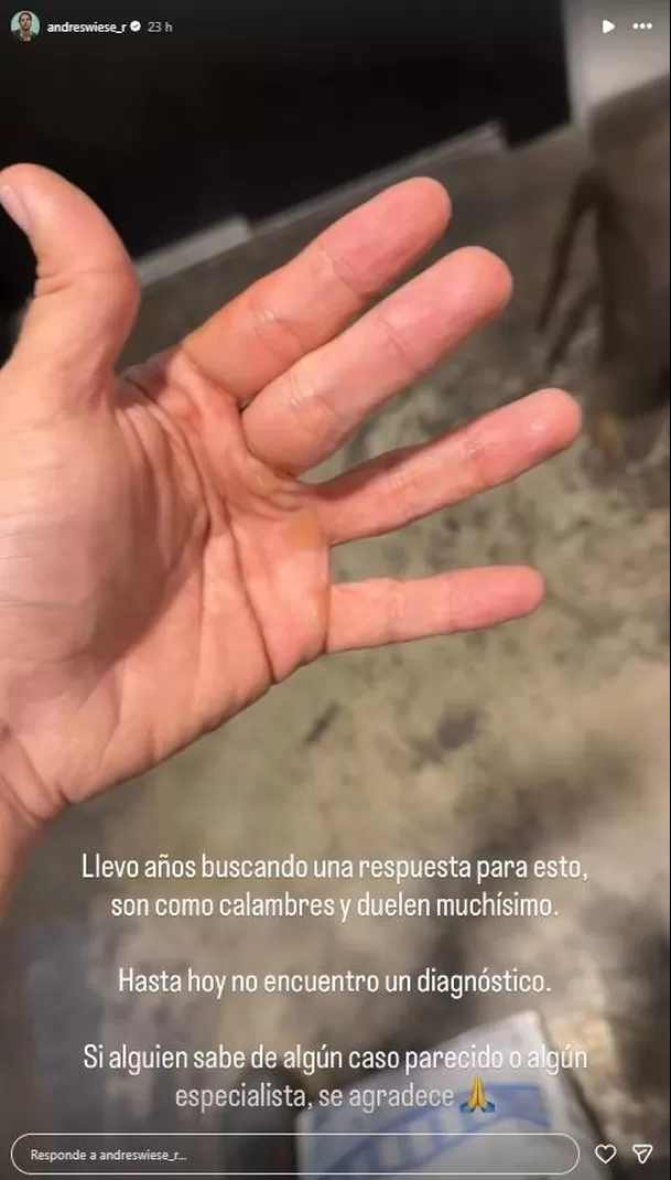 Andrés Wiese pidió ayuda por misteriosa enfermedad que afecta sus manos / Instagram