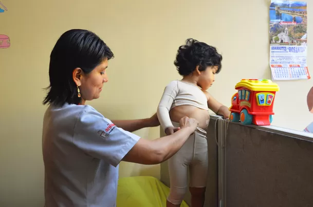 Durante estas jornadas, especialistas de Aniquem evaluarán a pacientes sobrevivientes de quemaduras para determinar el estado de sus cicatrices / Aniquem