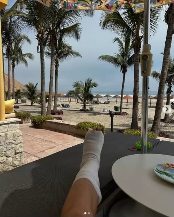 Anna Carina enfrentó semanas de dolor antes de recibir el diagnóstico correcto. Foto: Instagram Anna Carina enfrentó semanas de dolor antes de recibir el diagnóstico correcto. Foto: Instagram