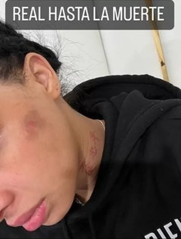 Yailin 'La más viral' denunció presunto maltrato físico de Anuel AA estando embarazada/ Foto: IG Yailin