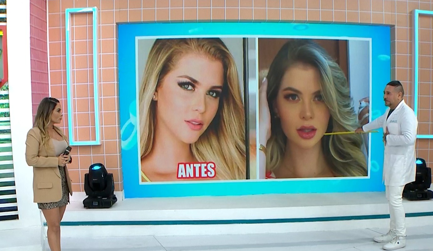 El programa 'América Hoy' reveló que Brunella Horna se sometió a un aumento de labios/Foto: América Hoy