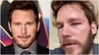 Chris Pratt sufrió ataque de abejas y terminó con picadura en el ojo