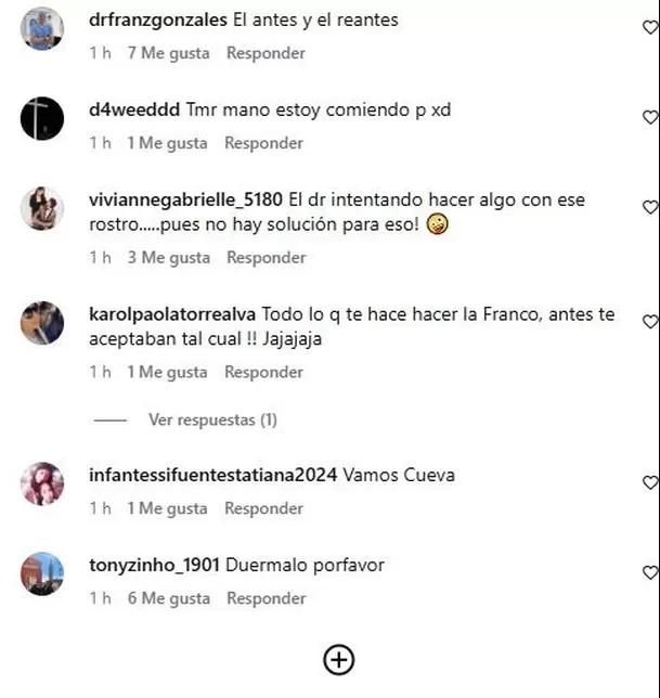 Reacciones en redes sociales tras retoque estético de Christian Cueva / Captura