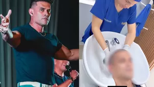 Christian Domínguez finalmente mostró cómo quedó tras ser rapado. El cantante compartió videos desde la clínica y dejó ver su nuevo look, luego de mantener el cambio en misterio