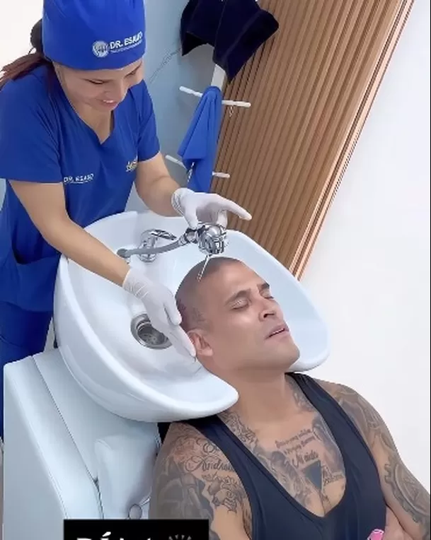 Christian Domínguez finalmente mostró cómo quedó tras ser rapado. El cantante compartió videos desde la clínica y dejó ver su nuevo look, luego de mantener el cambio en misterio Christian Domínguez finalmente mostró cómo quedó tras ser rapado. El cantante compartió videos desde la clínica y dejó ver su nuevo look, luego de mantener el cambio en misterio