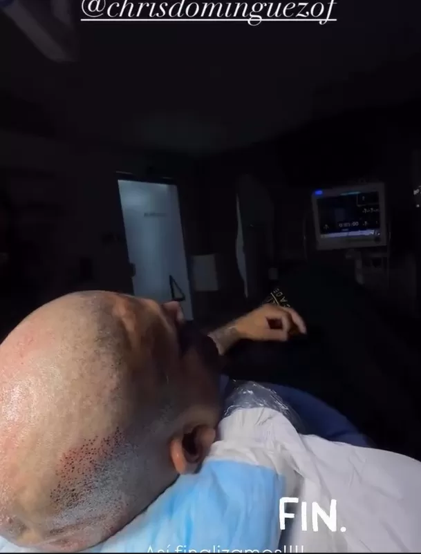 Christian Domínguez finalmente mostró cómo quedó tras ser rapado. El cantante compartió videos desde la clínica y dejó ver su nuevo look, luego de mantener el cambio en misterio Christian Domínguez finalmente mostró cómo quedó tras ser rapado. El cantante compartió videos desde la clínica y dejó ver su nuevo look, luego de mantener el cambio en misterio