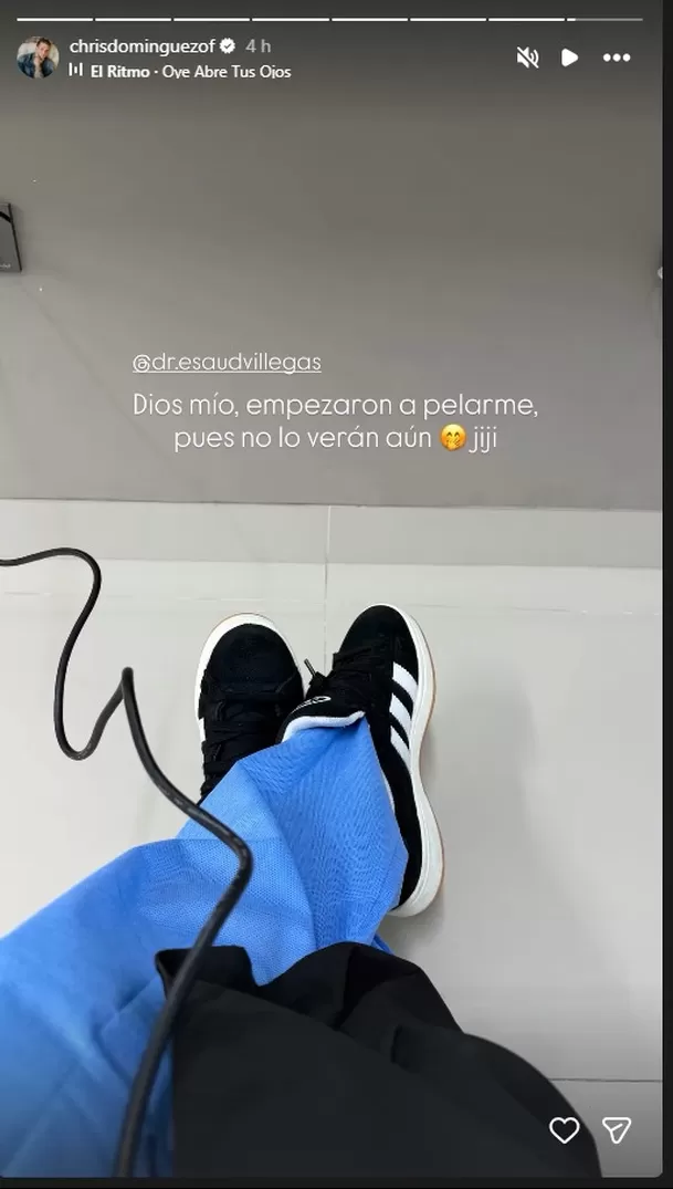 Christian Domínguez sorprendió al mostrar que se dejó rapar como parte de un procedimiento capilar. Foto: IG @christiandominguezoficial Christian Domínguez sorprendió al mostrar que se dejó rapar como parte de un procedimiento capilar. Foto: IG @christiandominguezoficial