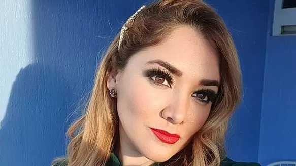 Sherlyn dijo que a la fecha no tiene mayores malestares. Foto: Instagram Sherlyn