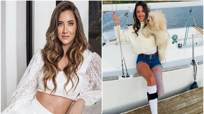 Recientemente, la modelo colombiana informó que su pie derecho no volverá a funcionar Recientemente, la modelo colombiana informó que su pie derecho no volverá a funcionar