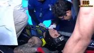 EEG: Jota Benz sufrió fuerte golpe en el rostro durante competencia con Irivarren