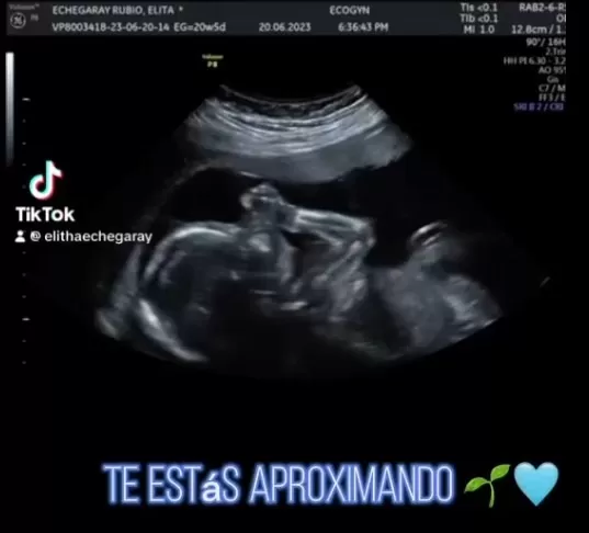 Elitha publicó la ecografía de su hijo que será un varón/ Foto: TikTok Elitha Echegaray