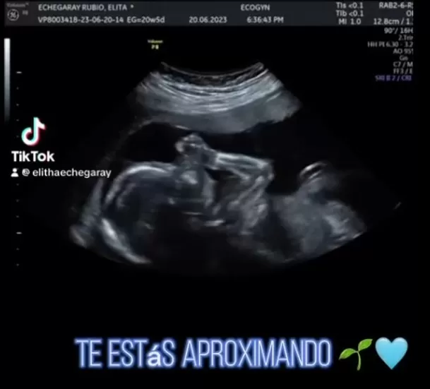 Elitha publicó la ecografía de su hijo que será un varón/ Foto: TikTok Elitha Echegaray