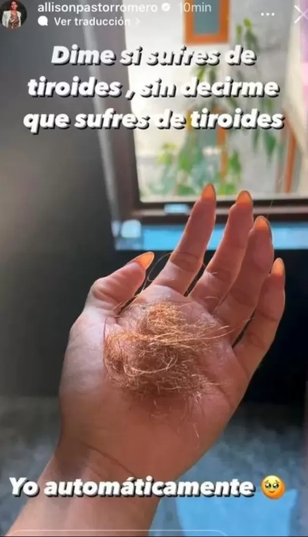 Allison Pastor dio detalles de la enfermedad que padece / Instagram