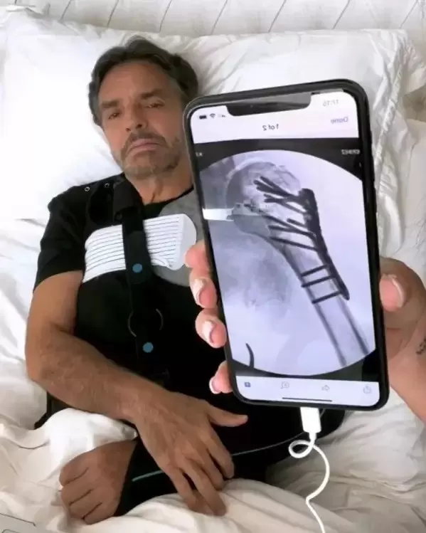 Eugenio Derbez rompió el silencio sobre su accidente en sus redes sociales. Fuente: Instagram/Eugenio Derbez