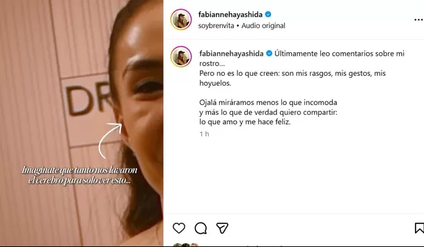 Fabianne Hayashida responde a quienes critican sus "cambios" en el rostro / Instagram Fabianne Hayashida responde a quienes critican sus "cambios" en el rostro / Instagram