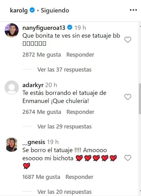 Comentarios de fanáticos de Karol G al ver que se está borrando el tatuaje de Anuel / Instagram